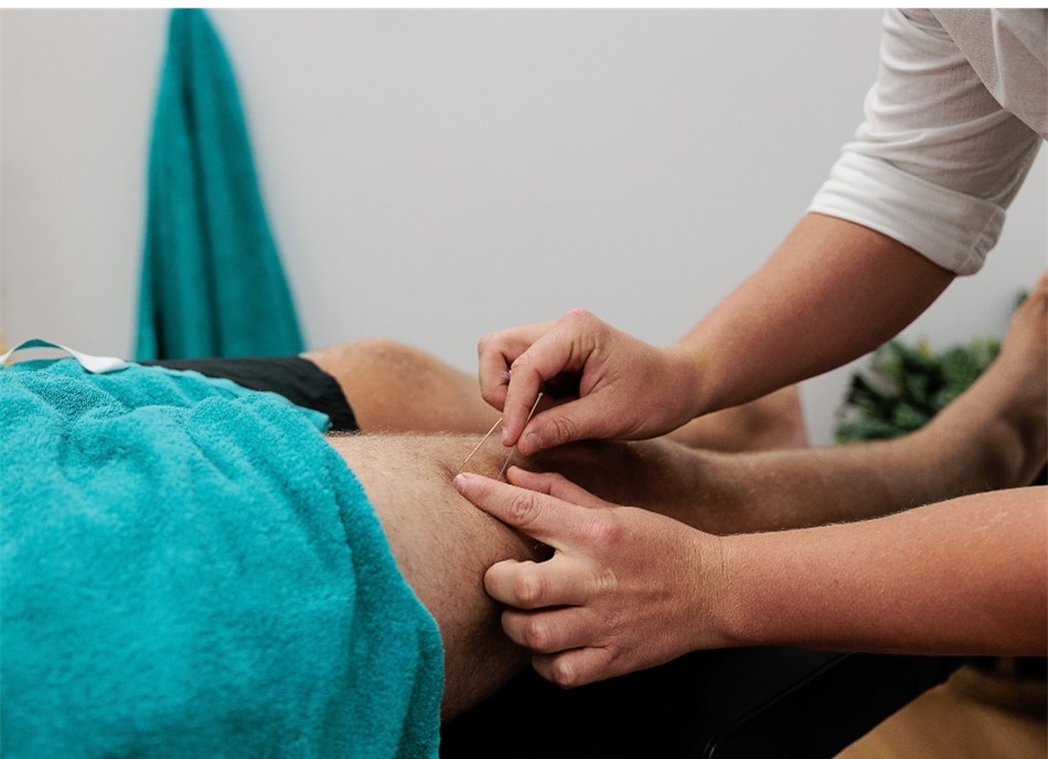 Dry needling treatment